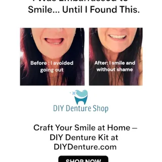 Photo of  DIY Denture Kit Full Set 